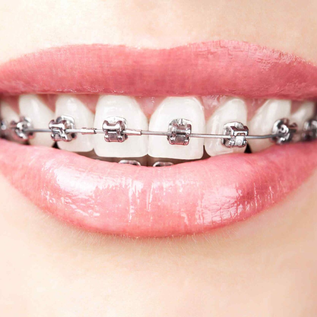 https://topcrayons.com/demos/dentist-1/wp-content/uploads/2020/01/post-03-1280x1280.jpg