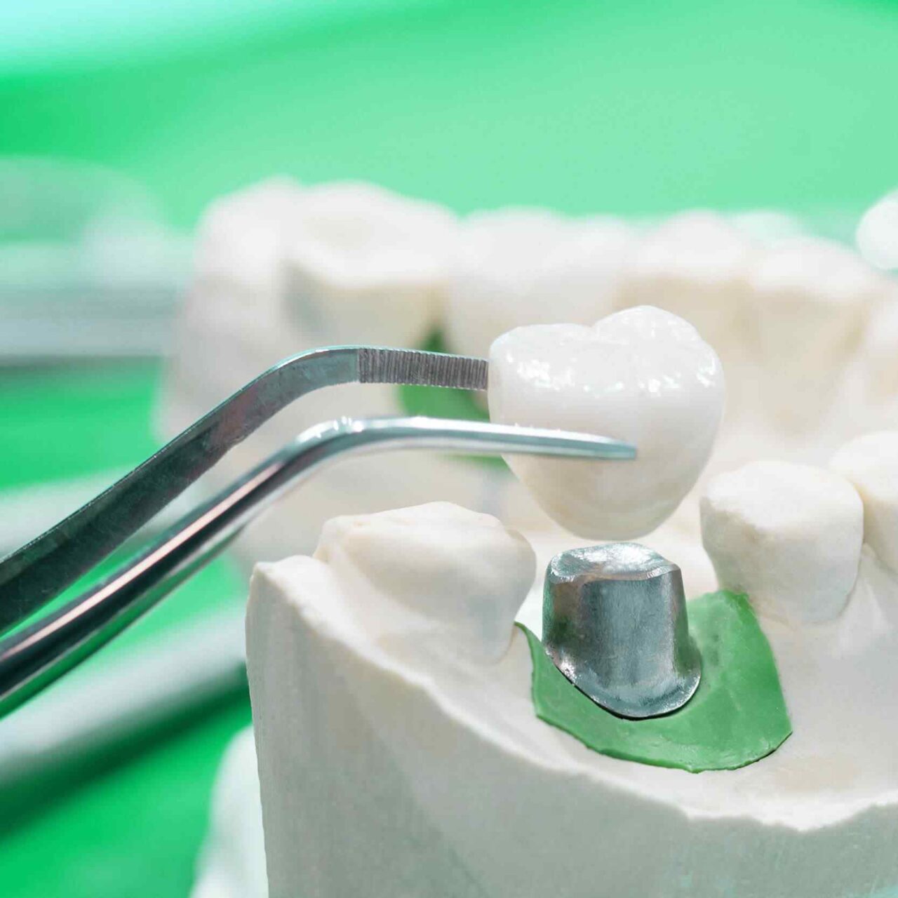 https://topcrayons.com/demos/dentist-1/wp-content/uploads/2020/01/post-28-1280x1280.jpg