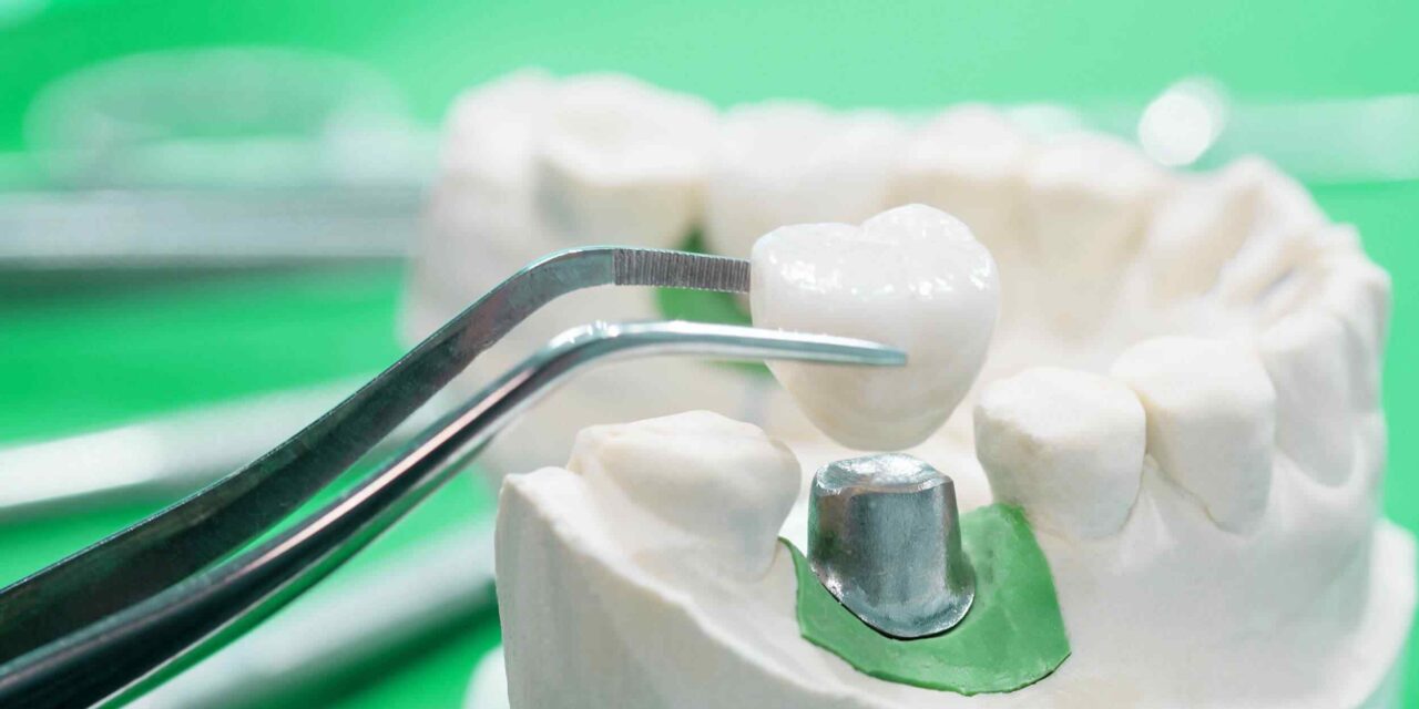 https://topcrayons.com/demos/dentist-1/wp-content/uploads/2020/01/post-28-1280x640.jpg